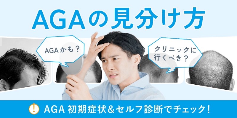 AGAの見分け方と髪の抜け方の特徴とは？薄毛の初期症状・進行速度