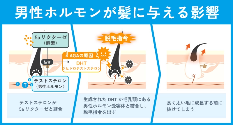 男性ホルモンのAGAへの影響