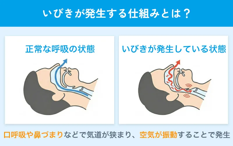 いびきが発生する仕組みは？